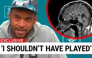 Tua Tagovailoa EXPOSES That His Team Let Him Play With A Concussion